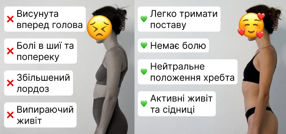 Спина без болю та гарна постава