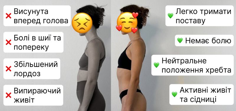 Спина без болю та гарна постава