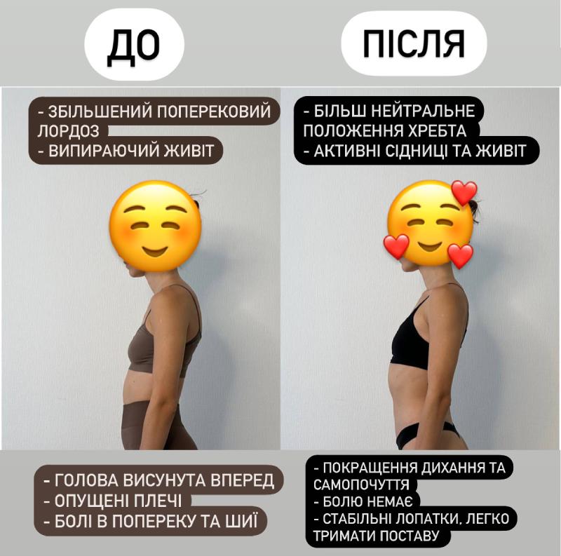 Спина без болю та гарна постава